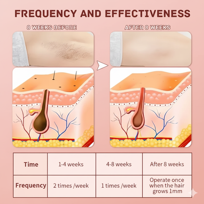 Lissea™ Home Hair Removal – SilkySmooth Results