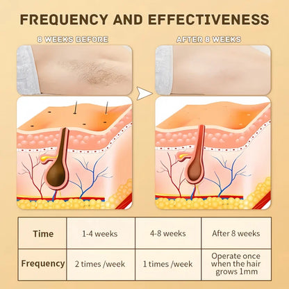 SilkySmooth Home Hair Removal™